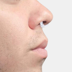 Anti-snurk Neusapparaat voor Comfortabele en Rustgevende Slaap-Beauty & Health-DeWoonVallei-DeWoonVallei